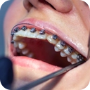 orthodontie-mega-menu2